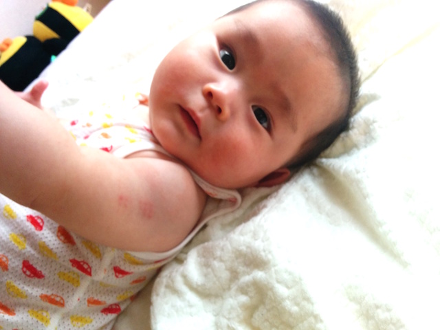 BCG 注射　6ヶ月　赤ちゃん